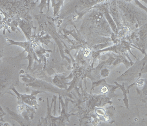 m-cardiomyocyte-beating